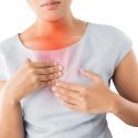 Refluxo: Conheça Os Sintomas E Tratamentos