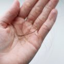 Queda De Cabelo: Suas Causas E Formas De Prevenção