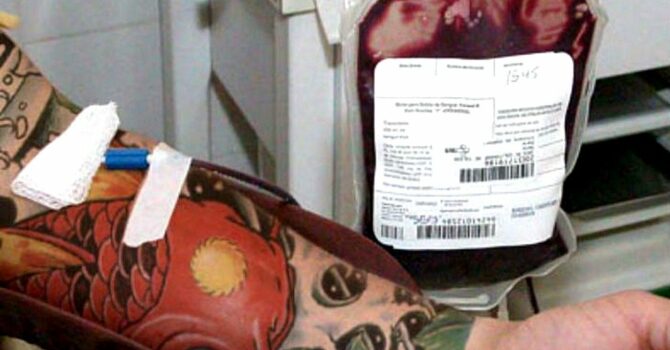 Doar Sangue Depois De Fazer Tatuagem (Foto: Remove Tatto)