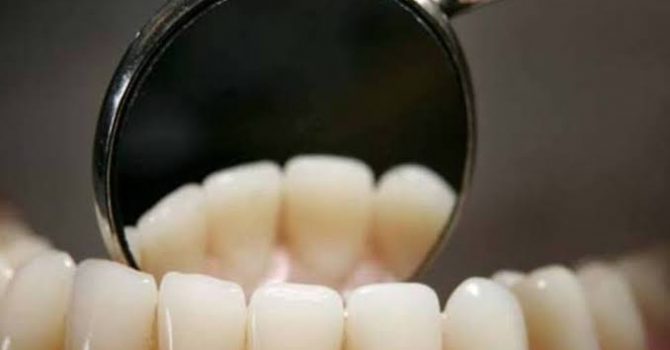 Confira 7 Dicas Para Melhorar A Saúde Dos Seus Dentes